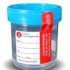 Sterile Urine Specimen Cups Blue Top with Temperature Strip | 190058 | Box of 25